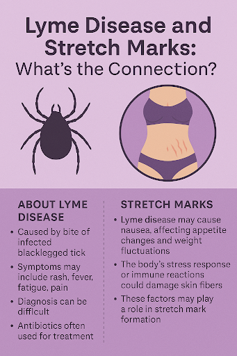 Lyme Disease and Stretch Marks: What’s the Connection?