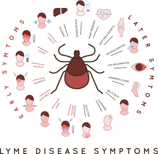 Early Signs of Lyme Disease: Key Symptoms to Watch For