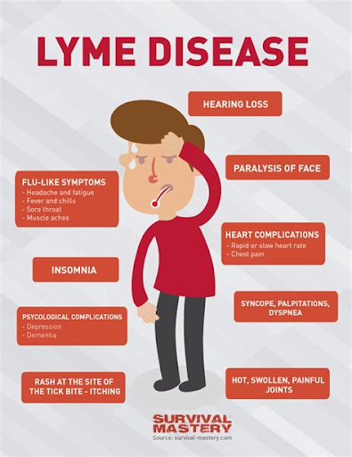 Flu-like Symptoms Relate to Lyme Disease
