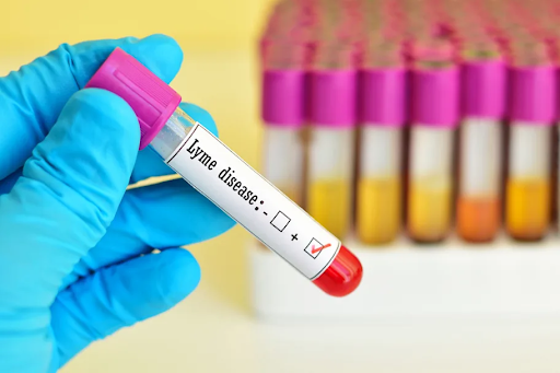 Diagnosing For Lyme Disease: Tests and Procedures