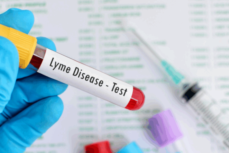 The Accuracy of Lyme Disease Blood Tests