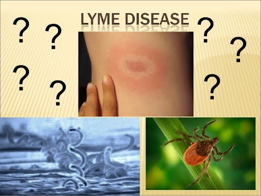 Lyme Disease and ALS: Debunking Myths and Explaining the Link