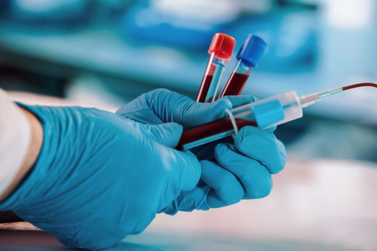 Lyme Disease Serology With Reflex: Understanding What It Really Means