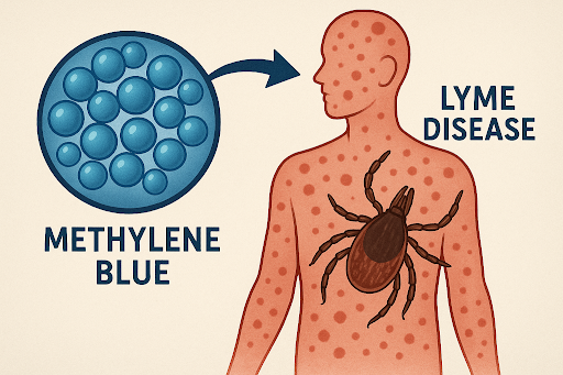 Can Methylene Blue Treat Lyme Disease? What Patients Need to Know